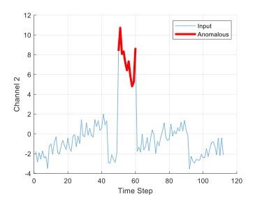 MATLAB figure showing a highlighted segment marking it as an anomaly.