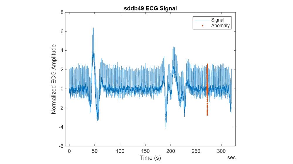 ECG data with detected anomaly shown in red.