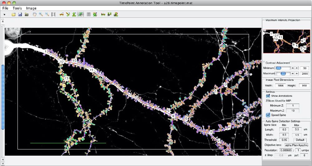 Figure 1. The MATLAB based Spine Tool, used to automate the detection, annotation, and analysis of dendritic spines.