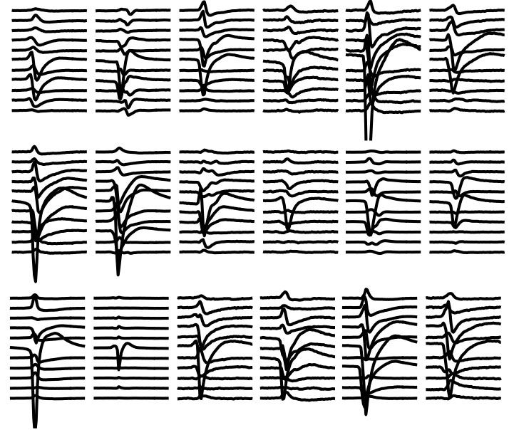 Abbildung 4: Darstellungen von 18 einzelnen Nervenimpuls-Formen, die von 11 unterschiedlichen Kanälen erfasst werden.