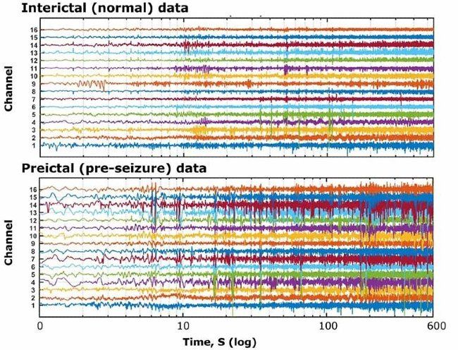 Abbildung 1: Von Kaggle zur Verfügung gestellte intrakranielle EEG-Daten.