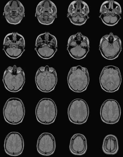 Im DICOM-Format gespeichertes MR-Bild