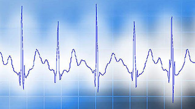 VivaQuant beschleunigt die Entwicklung und Validierung eines eingebetteten Geräts für ambulante EKGs