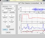 Digital Speech Processing