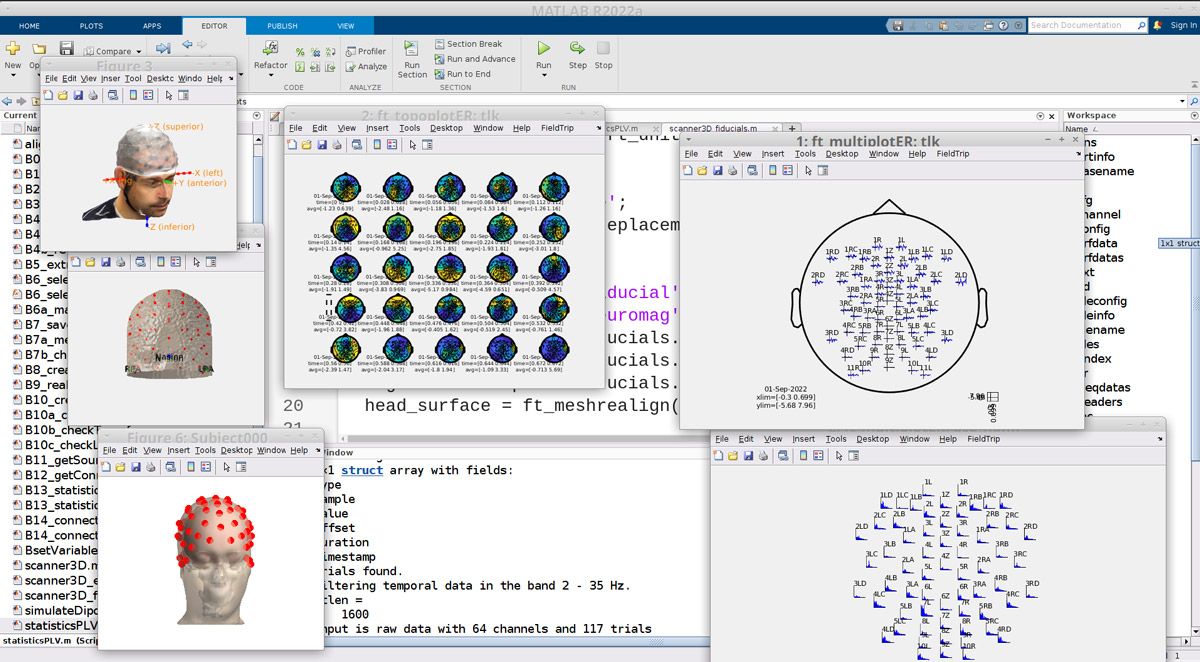 Screenshot of the diagnostic tool developed in MATLAB. The interface includes images of two heads wearing an EEG electrode cap. 