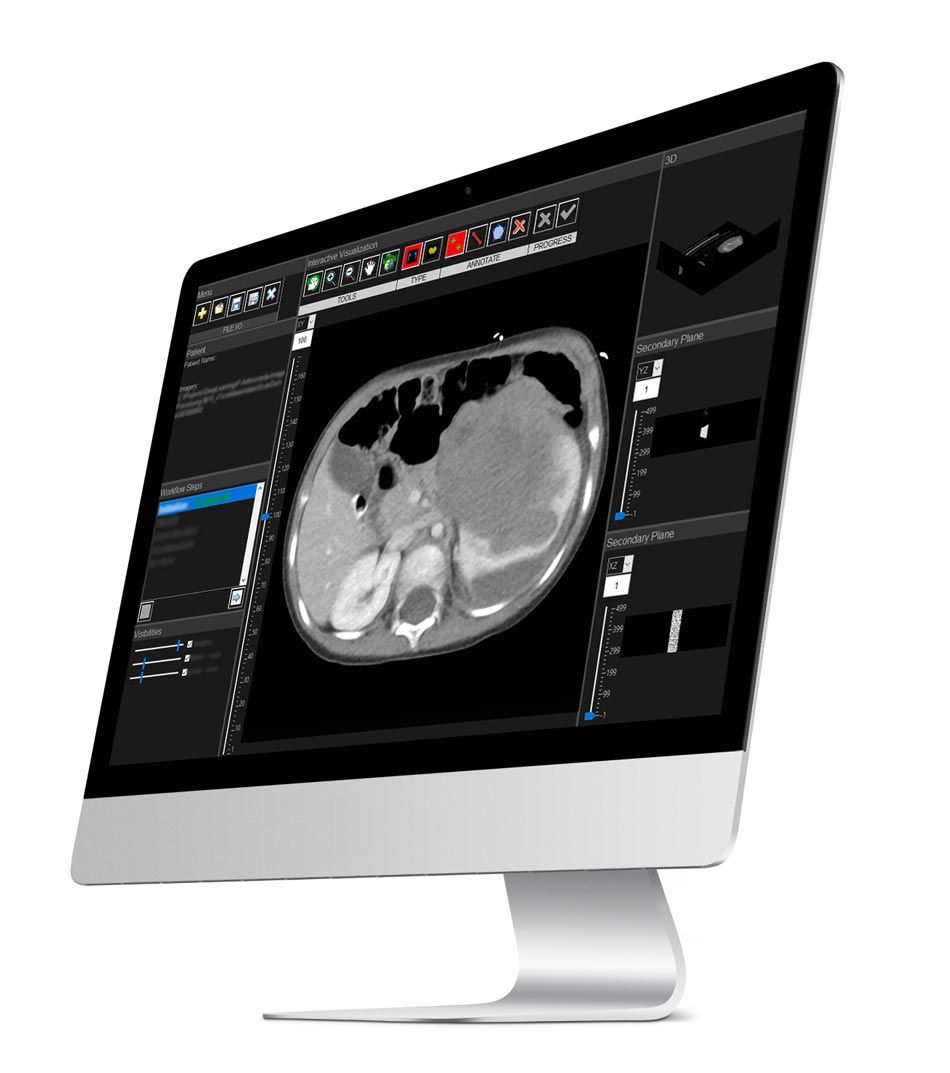Medical images processed in MATLAB on computer screen.