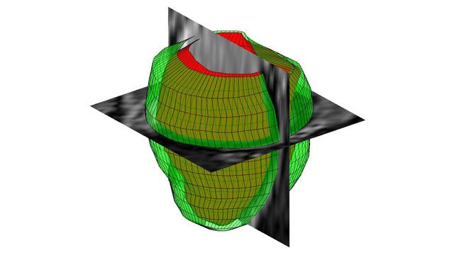 Traitement d'images 3D