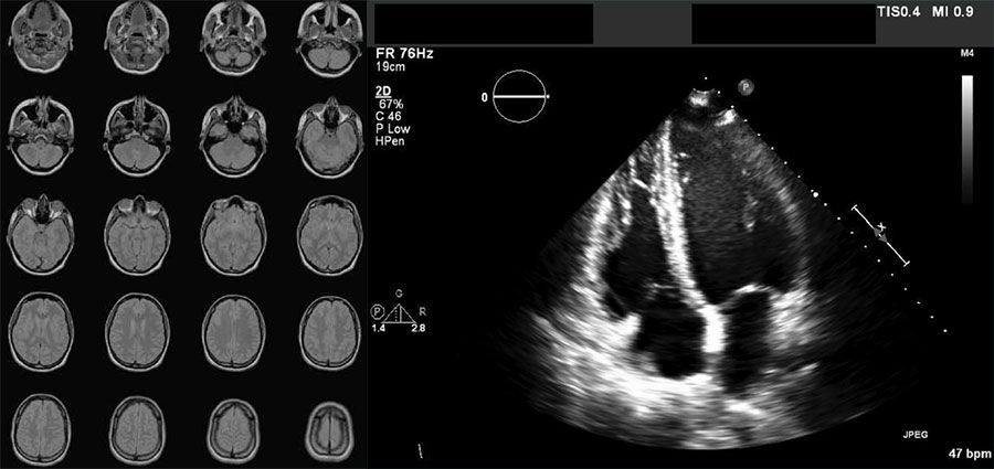 Exemples d'images au format DICOM : une série de 20 images issues d'une IRM cérébrale et une échographie cardiaque.