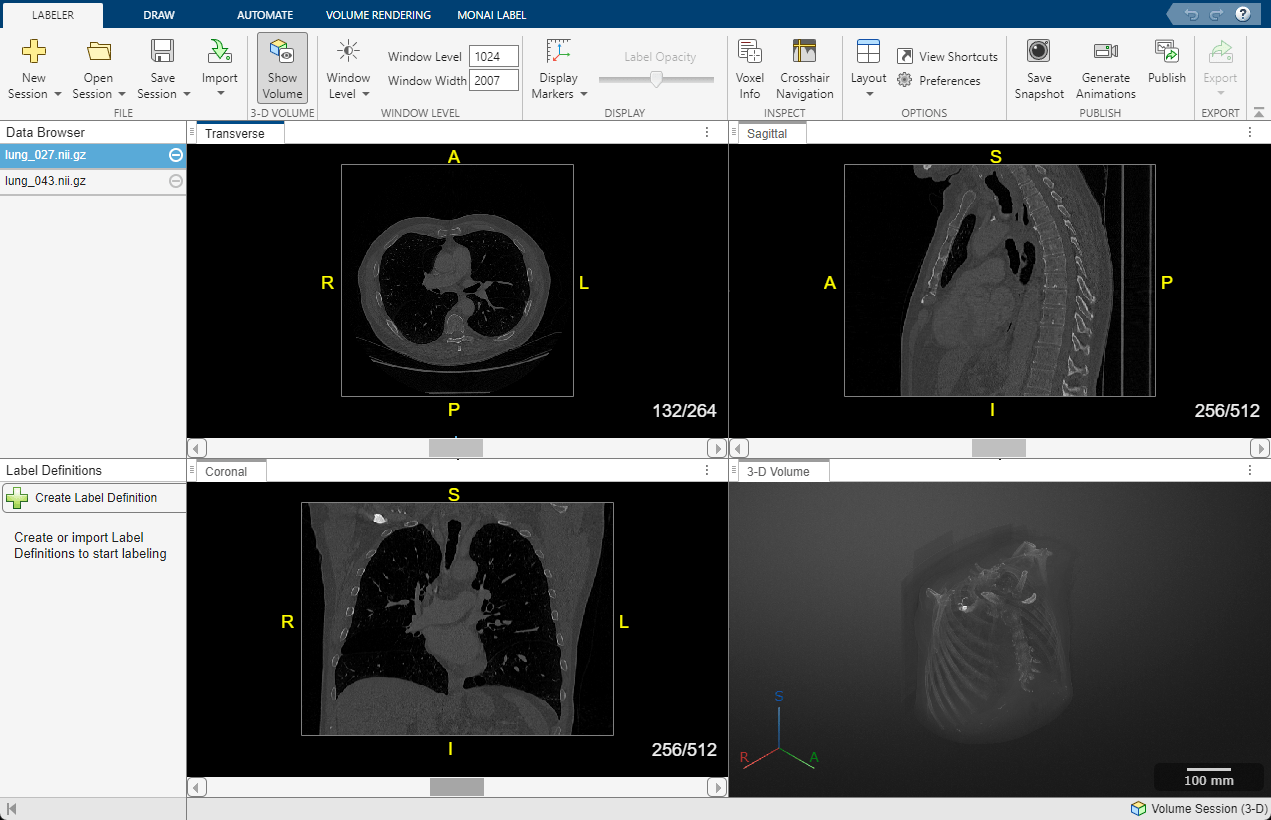 Capture d'écran montrant des images DICOM transversales, sagittales, coronales et volumétriques 3D d’une tomodensitométrie thoracique labellisé.