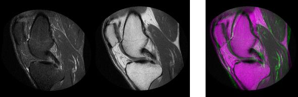 Automatic registration on multimodal medical images