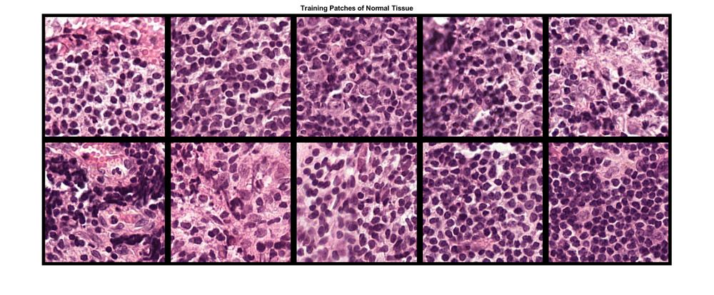 Training patches of tissue for deep learning classification of large multiresolution images.