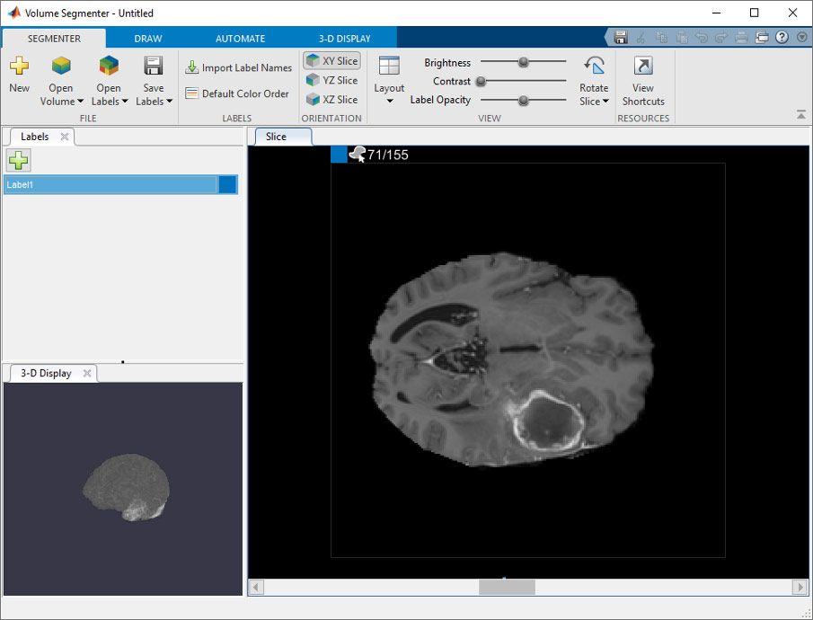 Volume Segmenter app, which displays a 3-D representation of the volume (in the 3-D Display pane) and individual slices of the data set (in the Slice pane).