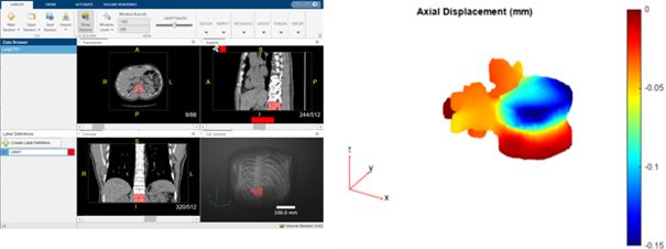 Screenshots showing examples of medical image segmentation: four CT scan images and a plot of axial displacement.