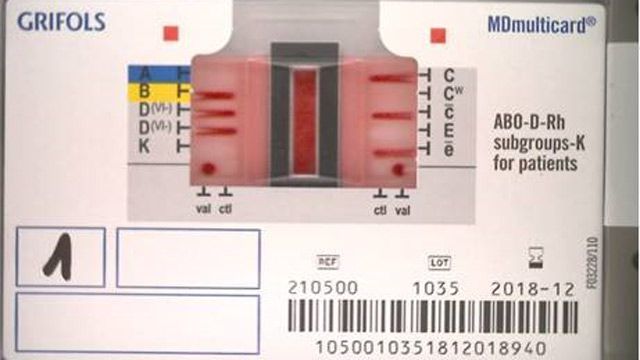 IDNEO développe des algorithmes embarqués de Computer Vision et de Machine Learning pour l'interprétation des résultats de groupes sanguins