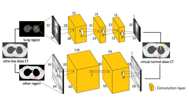 Utilisation du Deep Learning pour réduire le risque d'exposition aux rayonnements en tomodensitométrie