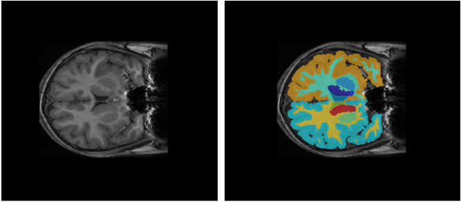 MRI image of the brain and ground truth segmentation mask of brain structures