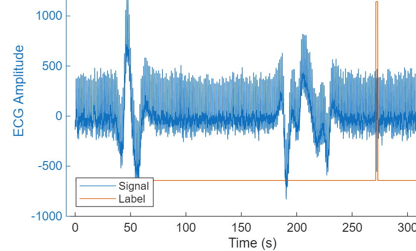 Figure contains an axes object. The axes object with title ECG Signal, xlabel Time (s), ylabel Annotation contains 2 objects of type line. These objects represent Signal, Label.