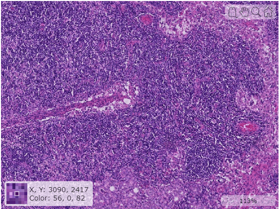 Appearance of displayed blocked image after zooming in, including the pixel information display in the lower-left corner.
