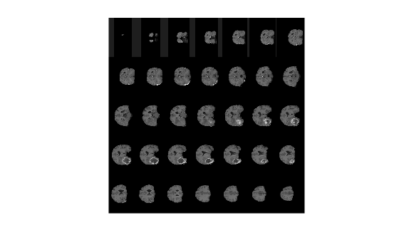 Figure contains an axes object. The hidden axes object contains an object of type image.