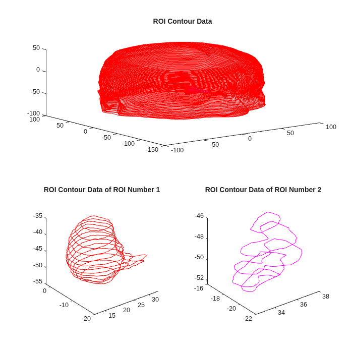 Figure contains 3 axes objects. Axes object 1 with title ROI Contour Data contains 109 objects of type line. Axes object 2 with title ROI Contour Data of ROI Number 1 contains 13 objects of type line. Axes object 3 with title ROI Contour Data of ROI Number 2 contains 5 objects of type line.