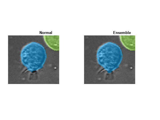 Figure contains 2 axes objects. Axes object 1 with title Normal contains an object of type image. Axes object 2 with title Ensemble contains an object of type image.