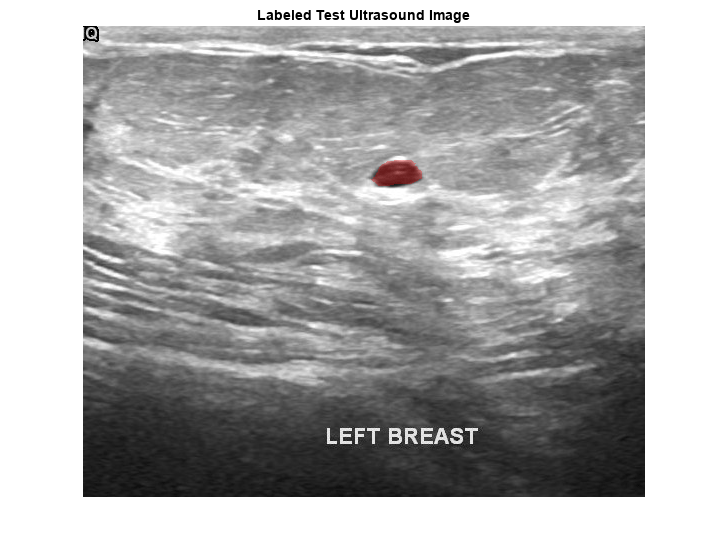 Figure contains an axes object. The axes object with title Labeled Test Ultrasound Image contains an object of type image.