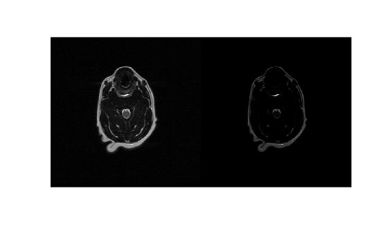 Figure contains an axes object. The hidden axes object contains an object of type image.