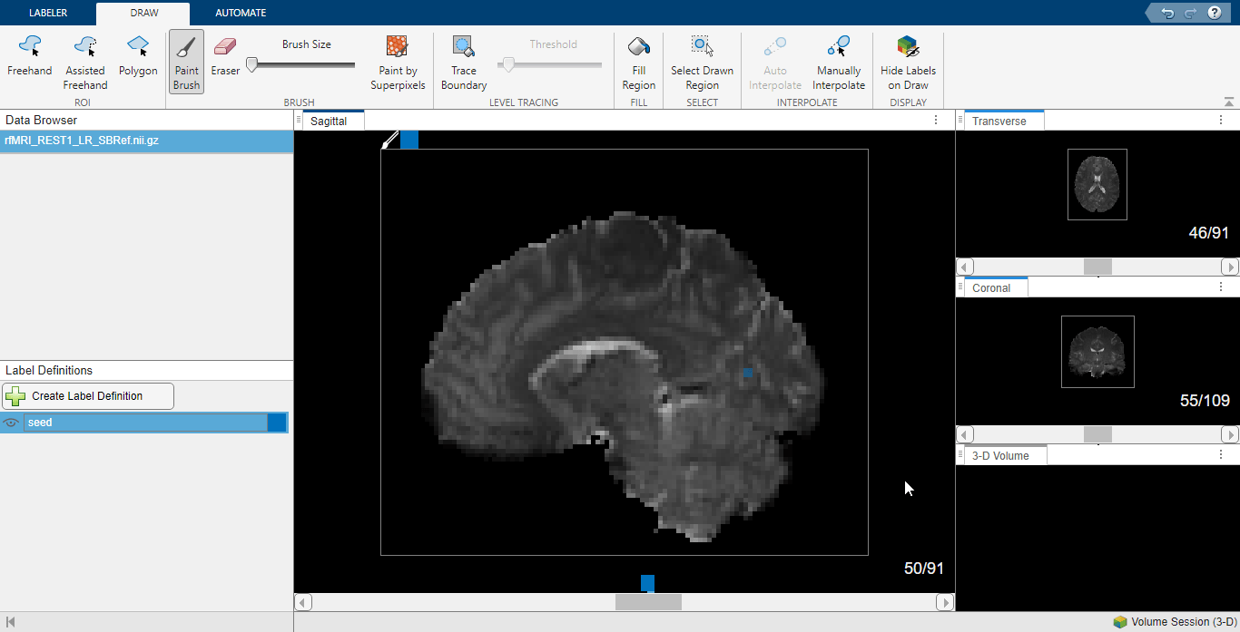 Labeled seed voxels in anatomical MRI in Medical Image Labeler.