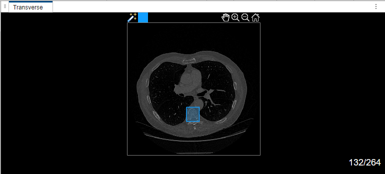 Bounding box in transverse view