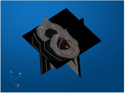 Viewer window showing the cursor paused on the transverse slice, which highlights in blue