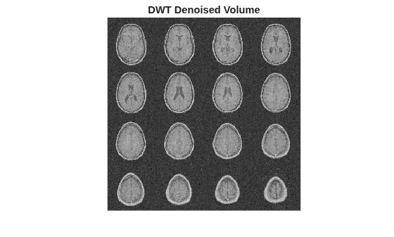 Figure contains an axes object. The hidden axes object with title DWT Denoised Volume contains an object of type image.