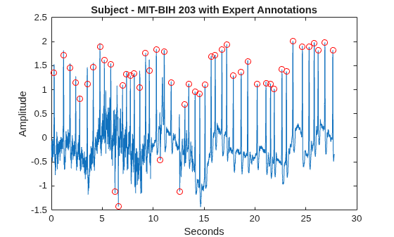 Figure contains an axes object. The axes object with title Subject - MIT-BIH 203 with Expert Annotations, xlabel Seconds, ylabel Amplitude contains 2 objects of type line. One or more of the lines displays its values using only markers