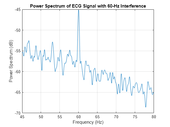 Figure contains an axes object. The axes object with title Power Spectrum of ECG Signal with 60-Hz Interference, xlabel Frequency (Hz), ylabel Power Spectrum (dB) contains an object of type line.