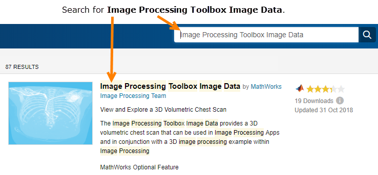 Searching for "Image Processing Toolbox Image Data" yields a link to the data package with an icon of the 3-D MRI chest scan.