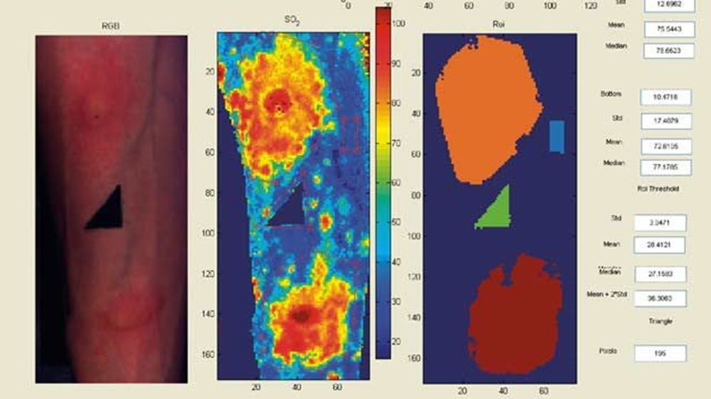 GUI analysis tool developed to acquire and process hyperspectral images to measure oxygen saturation.